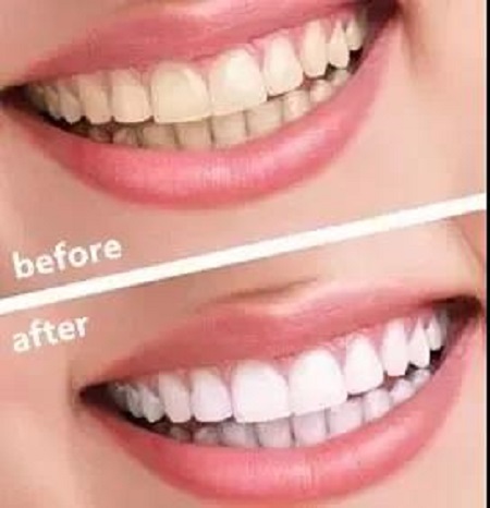 男神嫌棄和我親嘴怎么辦？求助在線等！