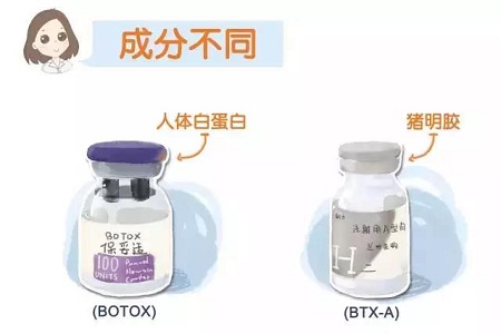 打瘦臉針，玻尿酸和衡力應該選擇哪種？