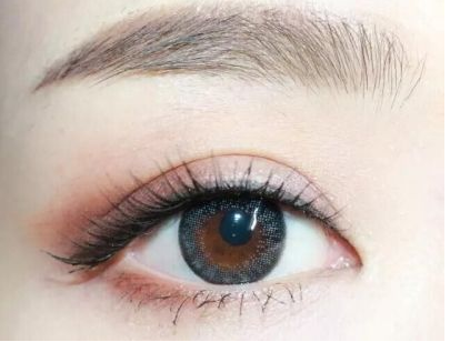 鄭州割雙眼皮術(shù)后恢復(fù)期需要多久