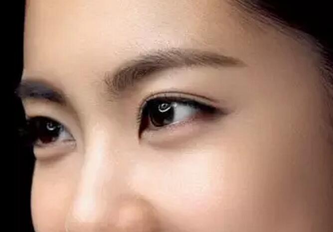 重慶做開(kāi)眼角手術(shù)的價(jià)格是多少錢?