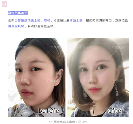 腫眼泡?重內眥?學會這幾招,秒get混血美眼!