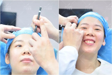 超值勁爆 | 玻尿酸,僅需?80!