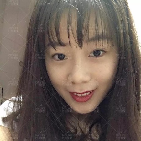 玻尿酸,僅需?80!