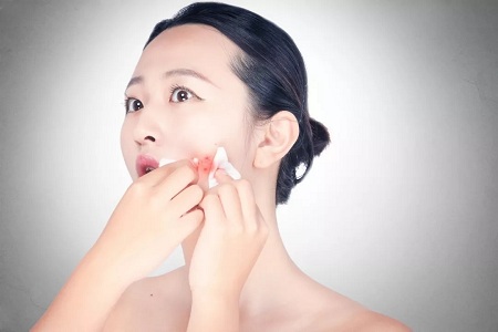 這些靠譜的去痘印方法,“萊”解決你的煩憂~