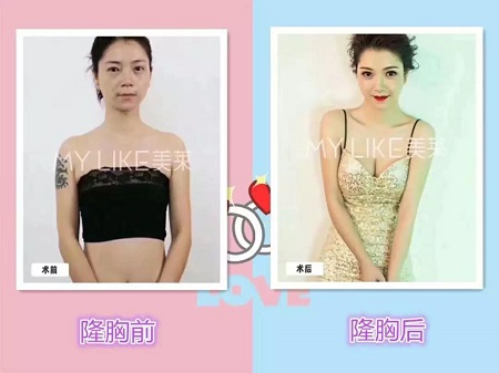 “南韓腿精”的胸也太過分了吧!