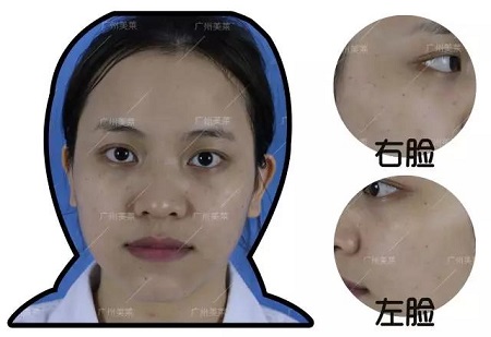 一旦長(zhǎng)了斑,再好的顏也只能做路人...