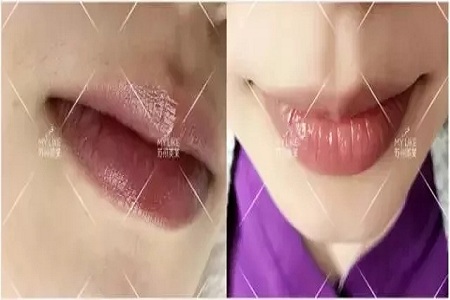 想過嗎?為啥有人的體毛多有的人少?