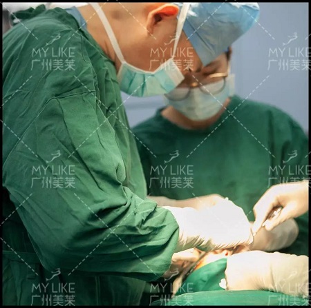 隆鼻后10天，從塌鼻素人變高冷女神！