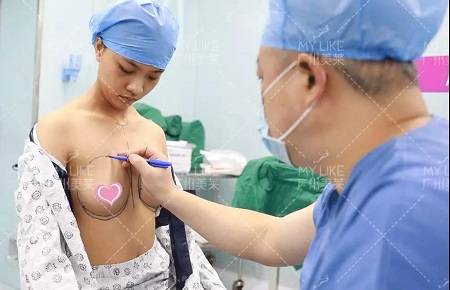 噴鼻血！34C罩杯的細(xì)腿精，抽了200ml脂肪隆胸！