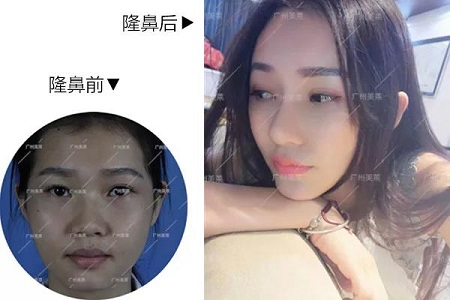 你的臉型,適合直鼻or翹鼻?