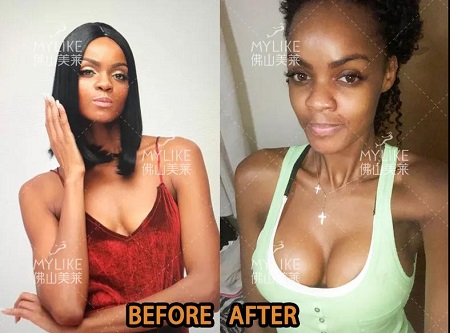 那位鼓起勇氣做了豐胸的模特Taty,現(xiàn)在怎么樣了?