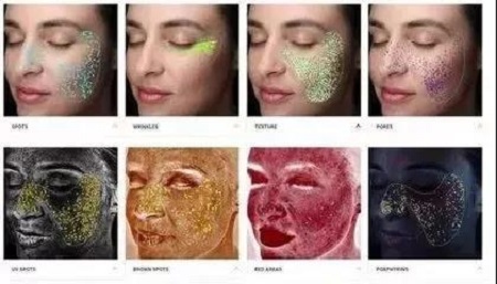 注意!祛斑方法不對,臉上的色斑會越來越深!