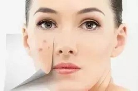 過度熬夜、吃太辛辣,長了痘為啥消不下去!?