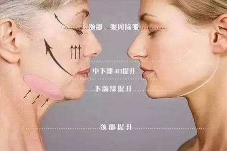 長了痘為啥消不下去!?