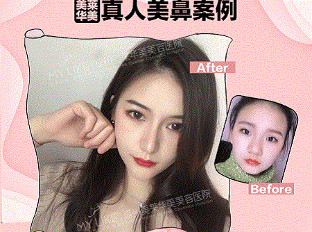 她曾丑到無人問津，現在卻擁有魔鬼身材，簡直是“行走的美人魚”