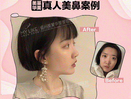 現在卻擁有魔鬼身材，簡直是“行走的美人魚”