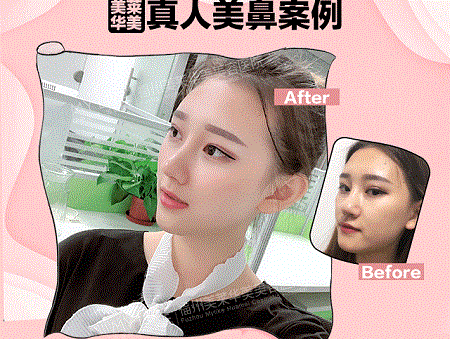 現在卻擁有魔鬼身材，簡直是“行走的美人魚”