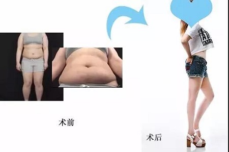 瘦1圈就像瘦30斤，這真的不是開玩笑！