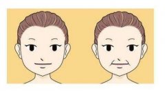 鄭州注射去除法令紋那種效果好？