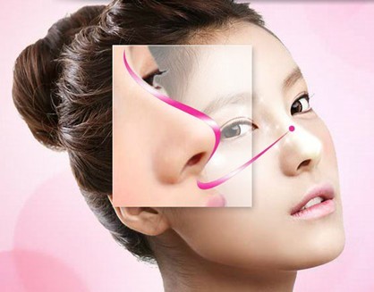 武漢鼻翼縮小術(shù)價(jià)格需要多少？