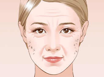 重慶做激光祛斑一次大概多少錢?