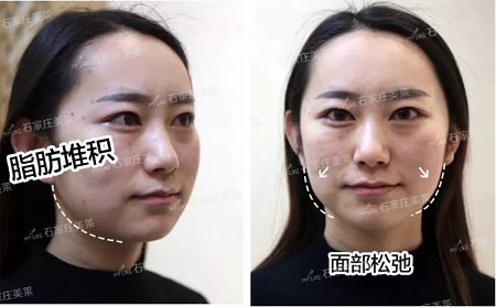 素顏邋遢老態，被嘲貴圈“照騙”！