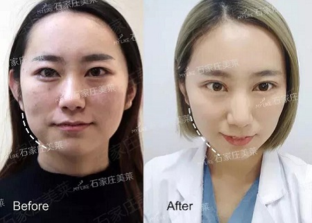 素顏邋遢老態，被嘲貴圈“照騙”！