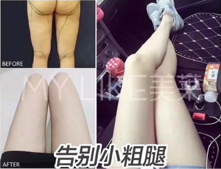 簡單幾招瘦小肚子,火速收藏!