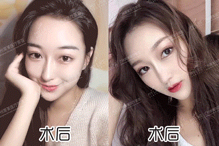 鼻子1個部位整得好，能拯救全臉！