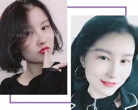 幼齒顏3要素，你的脂肪夠嗎？