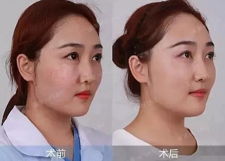 全日本女生較想整容的范本竟是她?!