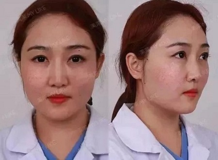 全日本女生較想整容的范本竟是她?!