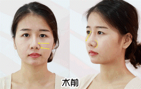 換對鼻子宛如換了一張臉,