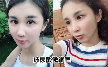 阿姨臉化身顏值擔當，微調效果到底有多美？