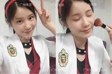 脂肪填充這3個部位,讓你更美更年輕!