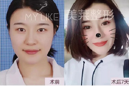 有圖有真相!每一個(gè)單眼皮的妹子都是潛力股~