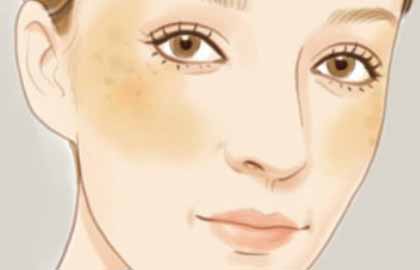 廣州美萊醫療美容醫院祛斑效果好嗎?