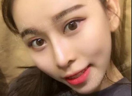 案例親測(cè)示范捏鼻！