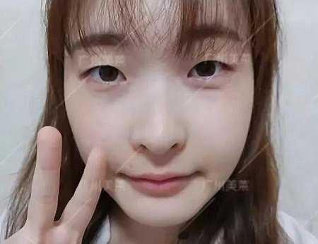 祛斑較全科普，頑固斑、反黑斑有救啦！