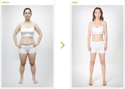 天津全身吸脂手術價格是多少錢?