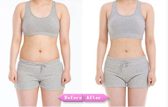 南京腰部吸脂價格是多少?