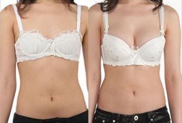 武漢豐胸注射副作用如何預防?