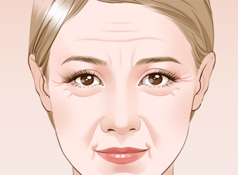 天津自體脂肪注射除皺價格?