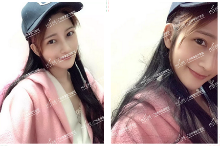 95后廣州女仔,連整2個部位,7天逆襲混血女神!