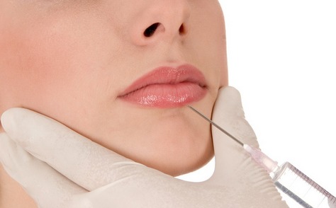 玻尿酸豐唇優點有什么?要多少錢?