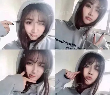 脂肪填充1周后,小喪臉竟嫩過(guò)少女!