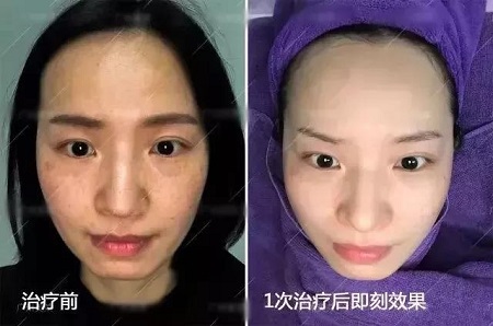 你不長斑誰長斑!