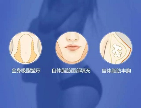 3月10、27、28日，世界吸脂勝者王志軍來了！