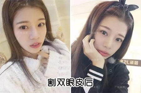 唱跳俱佳的她,割雙眼皮后都可以出道了!