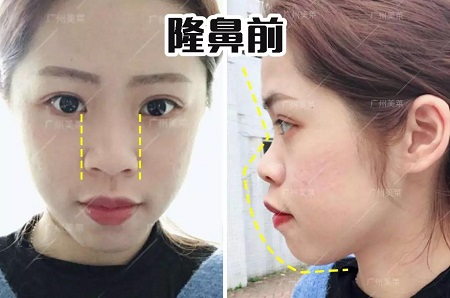 只差1個鼻的距離!